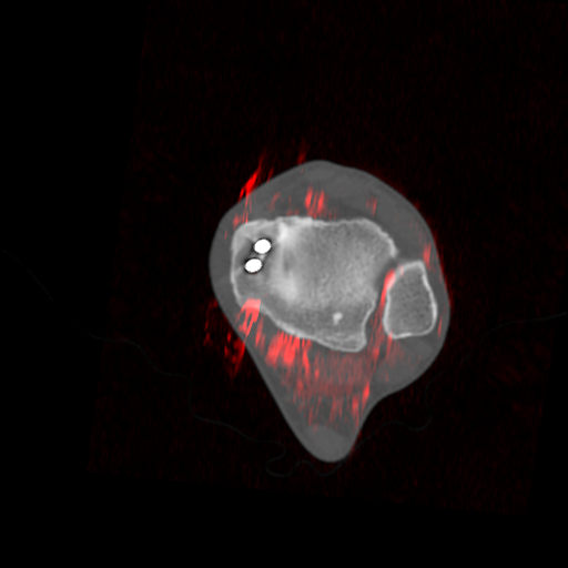 CT MRI ankle viewer preview