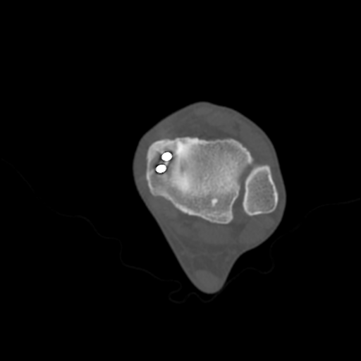 April 2025 DICOM-derived axial CT slice