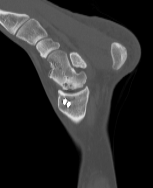 April 2025 DICOM-derived sagittal CT slice