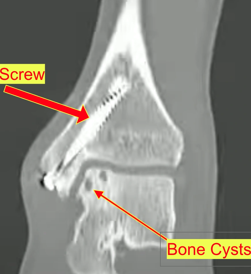 Ankle Injury Diagram 1