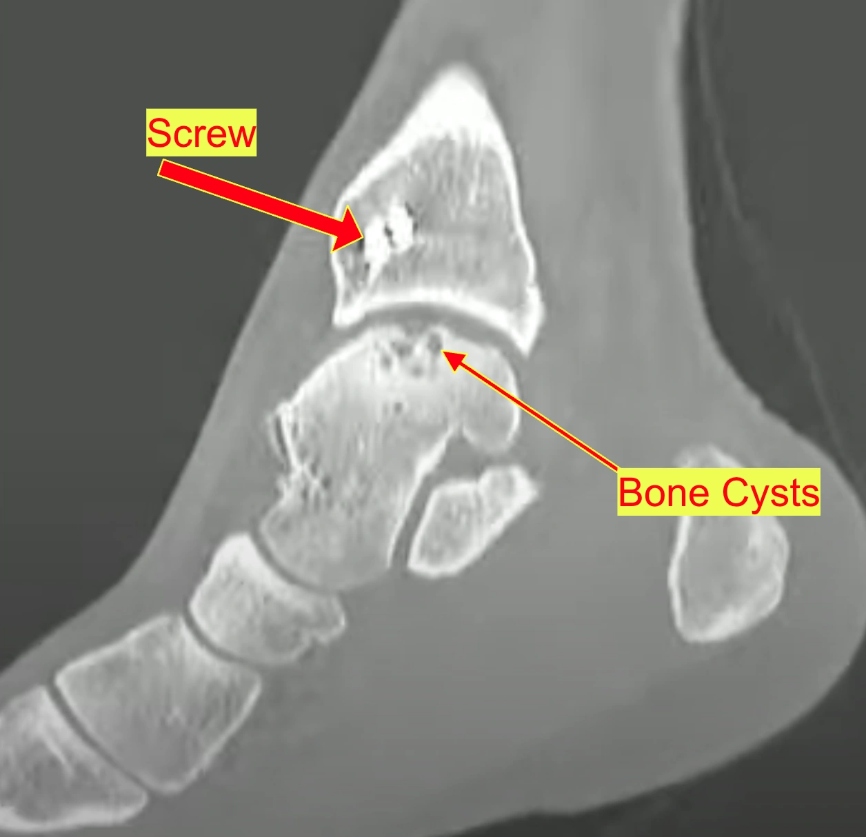 Ankle Injury Diagram 2
