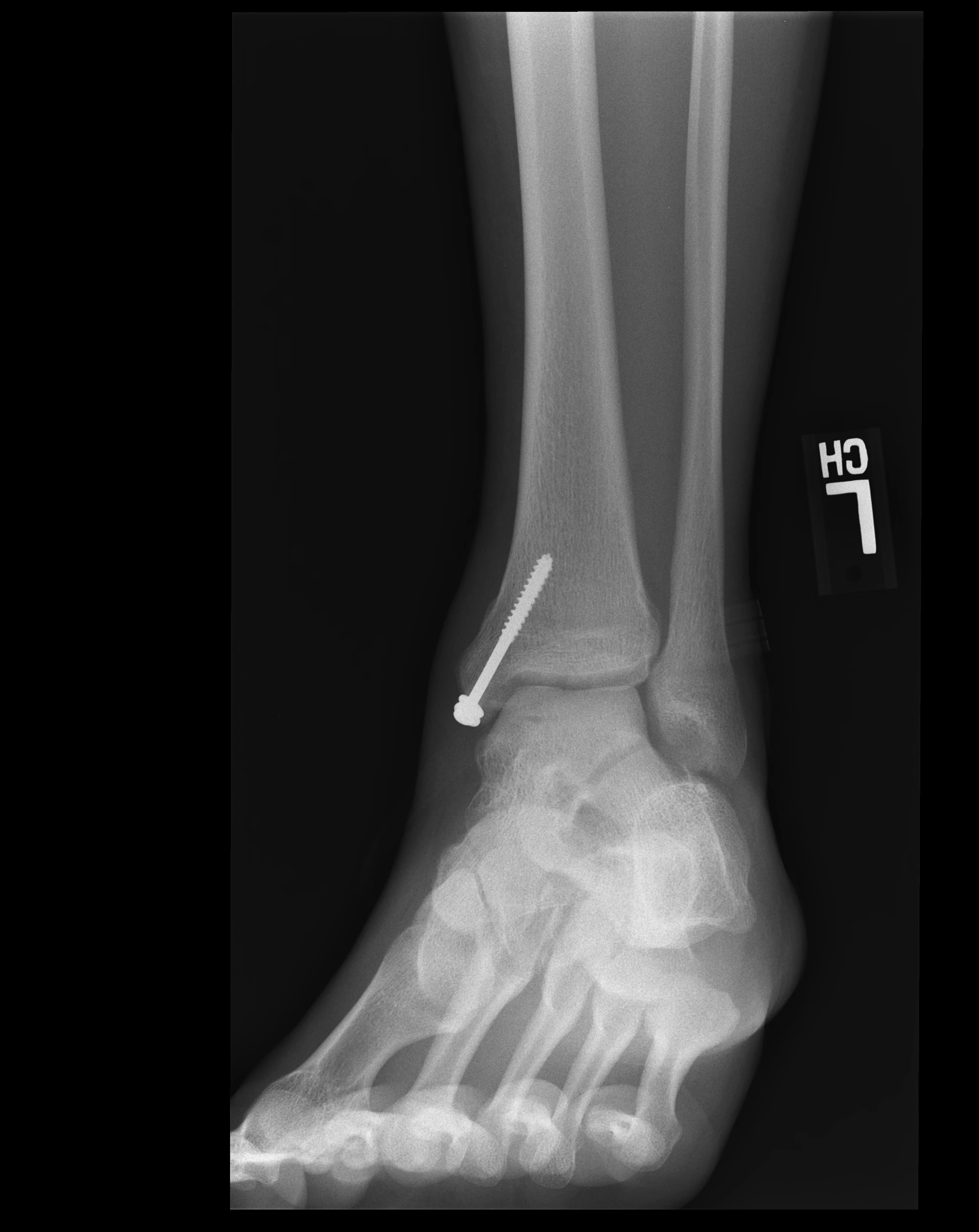 December 2012 X-ray