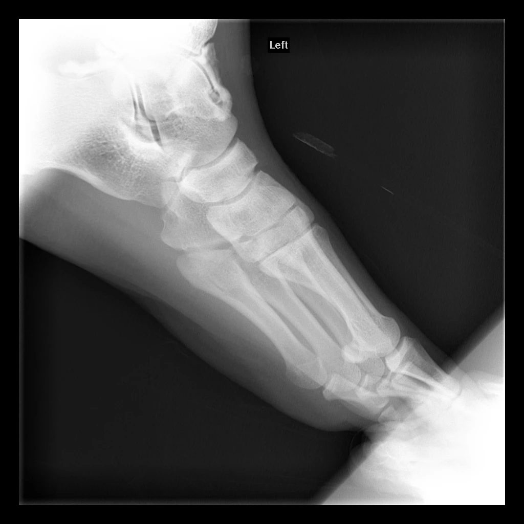 September 2012 Arthrogram